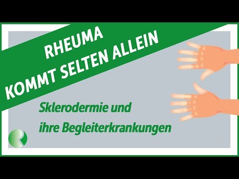 Rheuma kommt selten allein: Systemische Sklerodermie und ihre Begleiterkrankungen