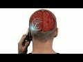 Brain Cancer - Dmitri Hvorostovsky - Cell Phones Definitely Cause Brain Tumors, Russian Baritone