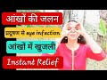 आंखों में जलन, खुजली, infection का तुरंत इलाज | Instant relief in eye infection, itching, burning