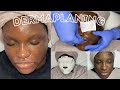 Oil Planing Before and After | Amazing Results