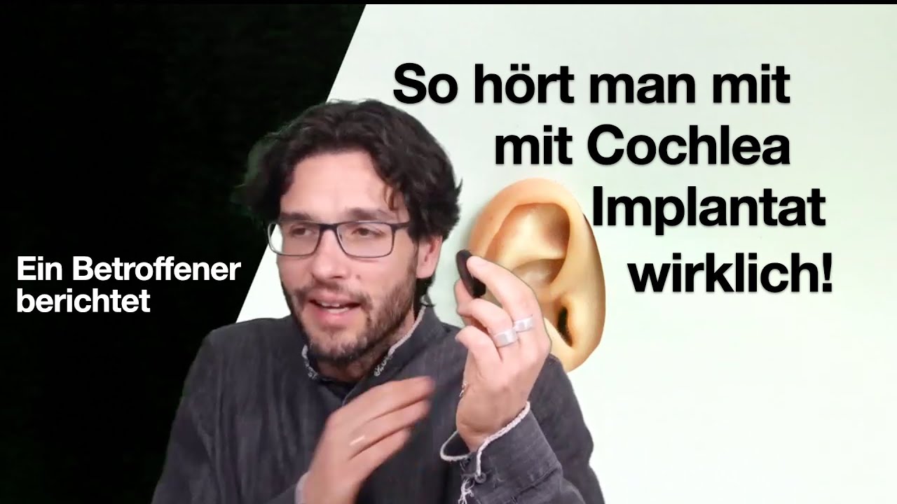 So hört man mit Cochlea Implantat wirklich (Ein Betroffener erzählt)