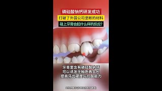 北京博士大叔潜心研究十余年，磷硅酸钙钠材料取得重大突破