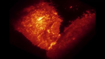 Endosomal Trafficking in a Single Cell - Dr Arumugam