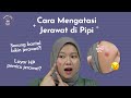 Misteri Jerawat di Pipi: Penyebab dan Solusinya