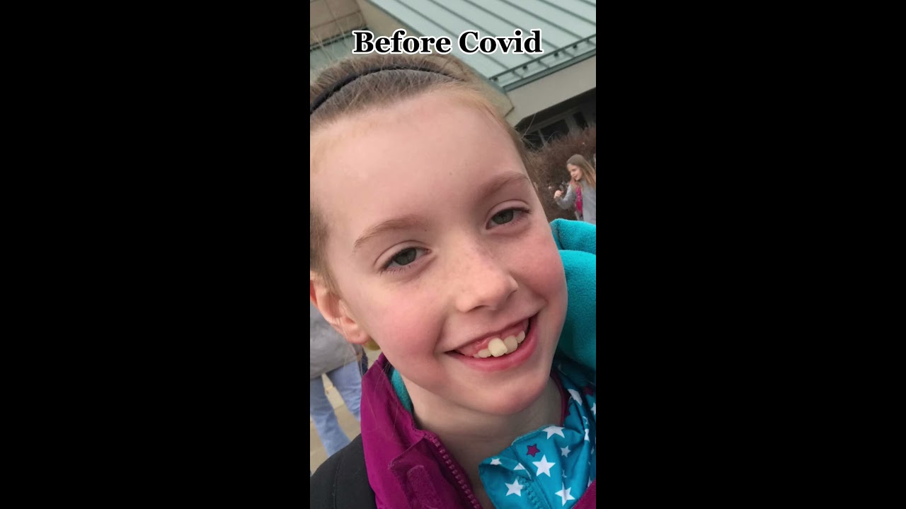 Glow Up 