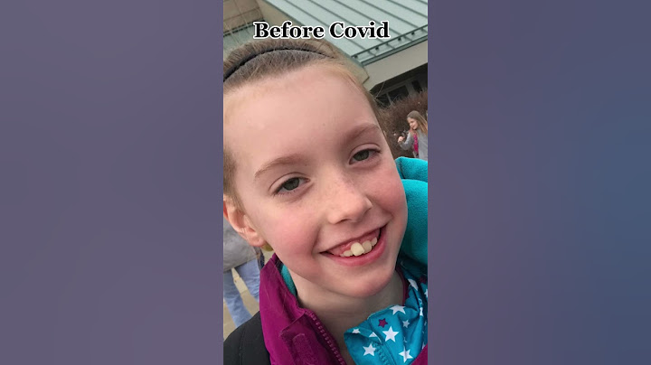 Glow up?