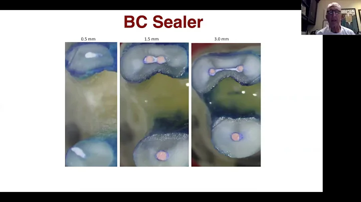 Dr  Richard Herman on Sealer Basics