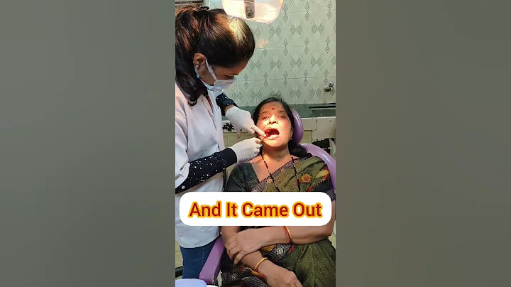 Wisdom Tooth Removal #shorts #trending #youtubeshorts #hindi #dr #ytshorts #teeth - DayDayNews