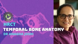 HRCT TEMPORAL BONE ANATOMY | DR ANAGHA JOSHI | OSSICLES | COCHLEA | CT MIDDLE EAR | CT INNER EAR