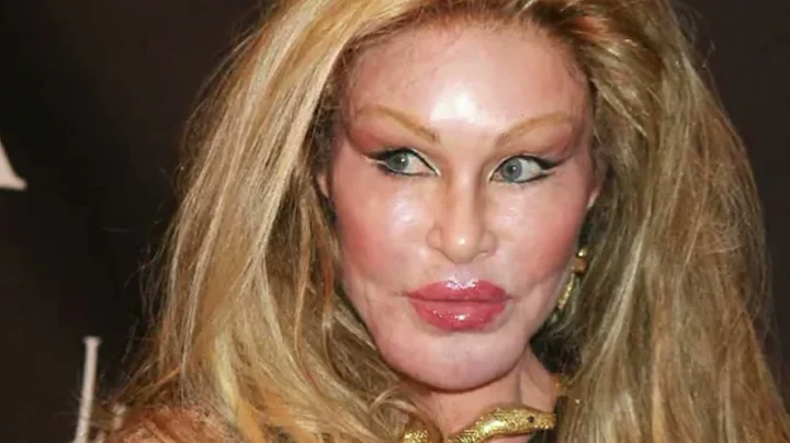 Jocelyn Wildenstein's Transformation Is A Must-See