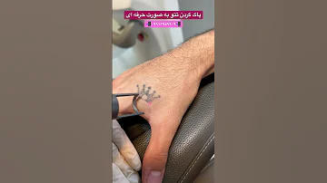 پاک کردن تتو کلینیک زیبایی استاربیوتی Tattoo Removal 