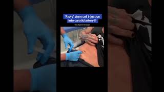 Stem cell injection into carotid artery?! #shorts