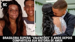 Brasileira Supera Valentões E Anos Depois Compartilha Sua História De Amor