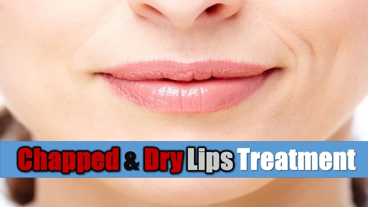 Home Remedies For Chapped Lips Best Chapped Lips Remedies YouTube