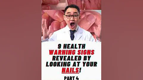 9 HEALTH WARNING SIGNS REVEALED BY LOOKING AT YOUR NAILS!  Part 4 #shorts