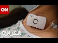 تعفن الدم كيف يساعد جهاز جديد بعلاج هذه الحالة الم هددة للحياة