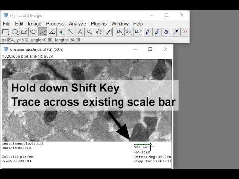 Creating Scale Bars In Imagej