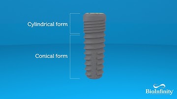 BioInfinity Dental Implant System