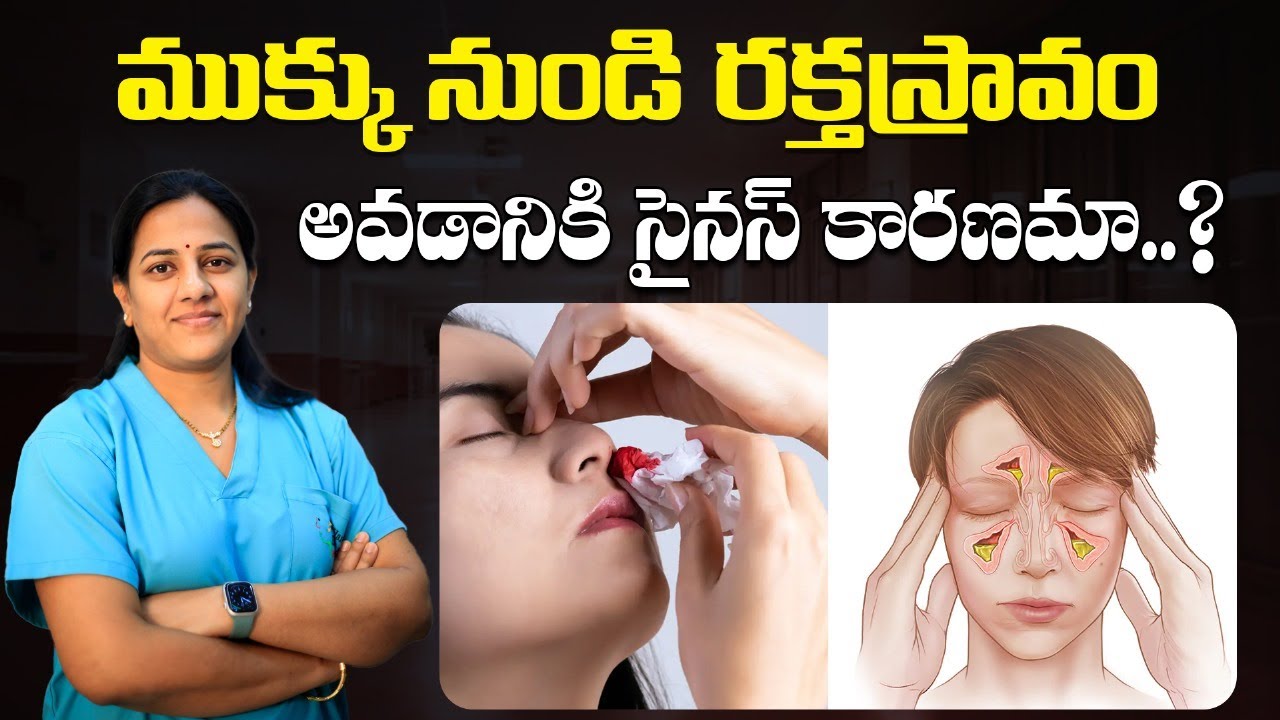 is-bloody-nose-a-symptom-of-sinusitis-best-ent-hospital-in-hyderabad
