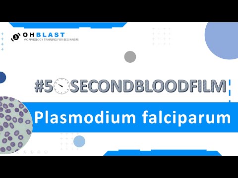 Video: Validácia DUTPázy Plasmodium Falciparum Ako Cieľ 5'-tritylovaných Deoxyuridínových Analógov S Antimalarickou Aktivitou