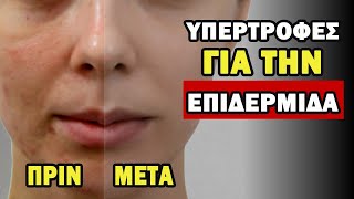 10 ΥΠΕΡΤΡΟΦΕΣ Για ΠΕΝΤΑΚΑΘΑΡΟ Δέρμα [ΠΡΟΣΘΕΣΤΕ ΣΤΗ ΔΙΑΤΡΟΦΗ ΣΑΣ!]