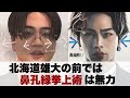 【鼻孔縁挙上じゃ無理ゲー】三杯目メンバーの鼻と輪郭が北海道雄大化した理由