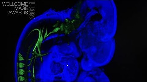 Optical projection tomography