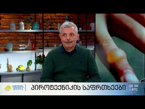 საახალწლო პიროტექნიკა, გამოყენების რისკები -  როგორ ავიცილოთ თავიდან მაშხალების ზიანი