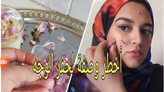 أسرع طريقة كندير باش نتهنا من حفر الوجه و المسامات الواسعة غادي تهنااااي و بمكون واحد