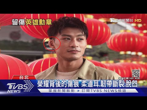 楊勇緯 柔道耳 花椰菜耳 餃子耳 耳廓假性囊腫 每天吃醋 痞客邦 楊勇緯 柔道耳 花椰菜耳 餃子耳 耳廓假性囊腫 每天吃醋 痞客邦