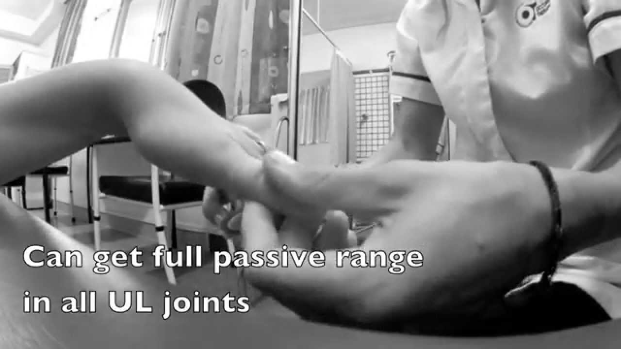 major field of study medicine Physical Rehabilitation following a Stroke. 'Matilda'