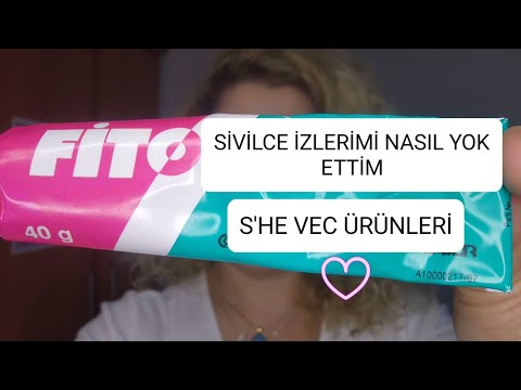 SİVİLCE İZLERİM NASIL YOK OLDU? |FİTO KREM | S'HE VEC ÜRÜNLERİ 🤔