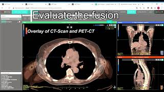 Annotate & SmartFuse results