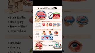 Intracranial Pressure (ICP) Explained in 60 Seconds | Medical Shorts 🧠⚠️