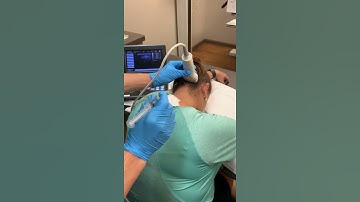 Migraine Headache Treatment: Occipital Nerve Blocks