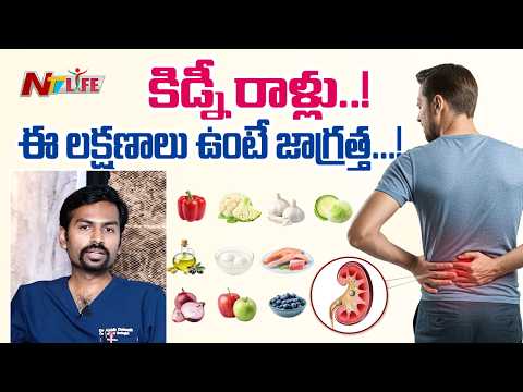 కిడ్నీ రాళ్లు: కారణాలు, లక్షణాలు, చికిత్స మరియు ఆహార నియమాలు | Dr. Abhik Debnath @PACEHospitals - NTVTELUGU
