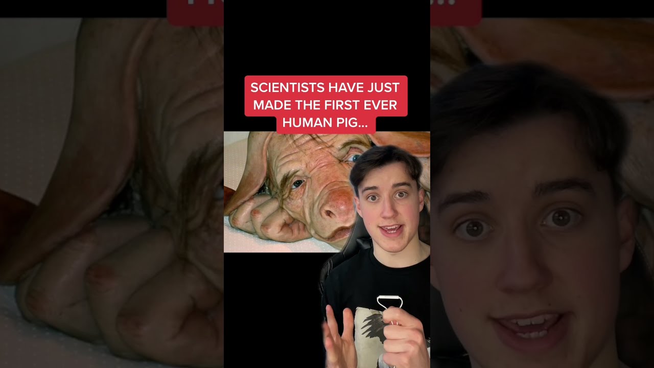 THE FIRST EVER HUMAN PIG Shorts