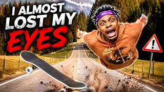 I ALMOST LOST MY EYES