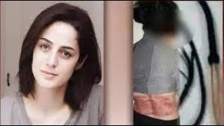 Iranian Woman Gets 74 Lashes For Not Wearing Hijab Flogging Punishment Caning Caning In Iran