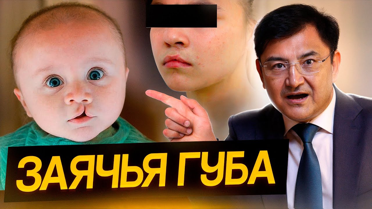ЗАЯЧЬЯ ГУБА / ПРИЧИНЫ ВОЗНИКНОВЕНИЯ И ЧТО ДЕЛАТЬ? (ВОЛЧЬЯ ПАСТЬ)