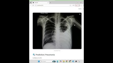🩻 Chest X-Ray Classification (Pneumonia Detection) machine learning python classification CNN