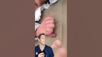 Doctor Reacts: born with an extra finger