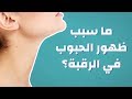ما سبب ظهور الحبوب في الرقبة موضوع 