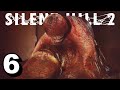 The Most DISTURBING BOSS EVER! | Silent Hill 2 Remake - Part 6