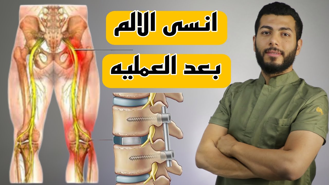 متى يختفى الالم بعد عملية تثبيت الفقرات |وداعاً الم اسفل الظهر بعد عملية الغضروف