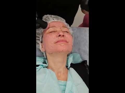 Treatment using OxyGeneo