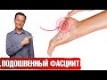 Боль в ступне: что делать? Плантарный фасциит 👉 есть решение