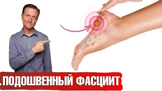 Боль в ступне: что делать? Плантарный фасциит 👉 есть решение