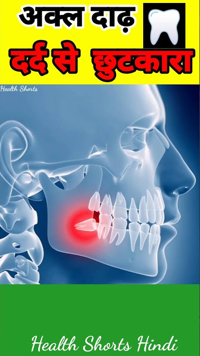 Akal daad ke dard ka ilaj || wisdom tooth pain removal in hindi || #wisdomtooth #health #shorts