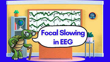 Focal Slowing in EEG - Recognition